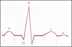 Normales EKG 